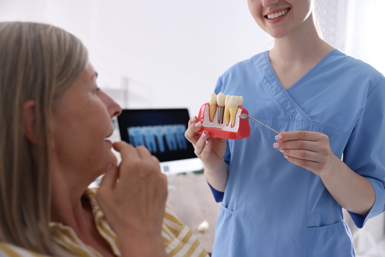 Dental Implants
