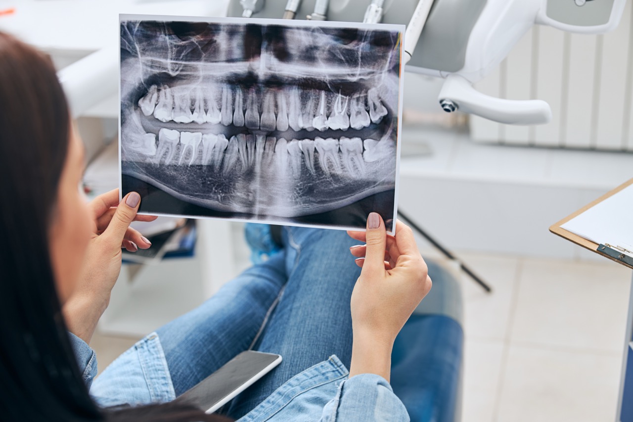 Root Canal Treatment (RCT) illustration 1
